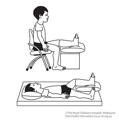 Fracture care: leg Fracture care: leg